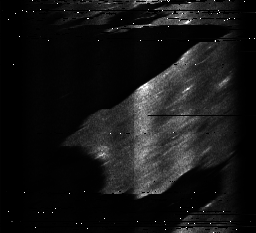 ascat_grayscale_ch1.png